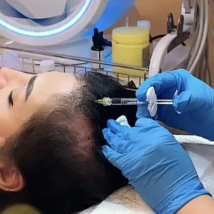 Haar-mesotheraphie-2