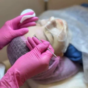 Hydrafacia-1