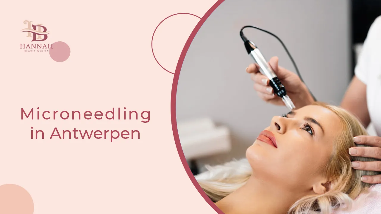 Microneedling in Antwerpen