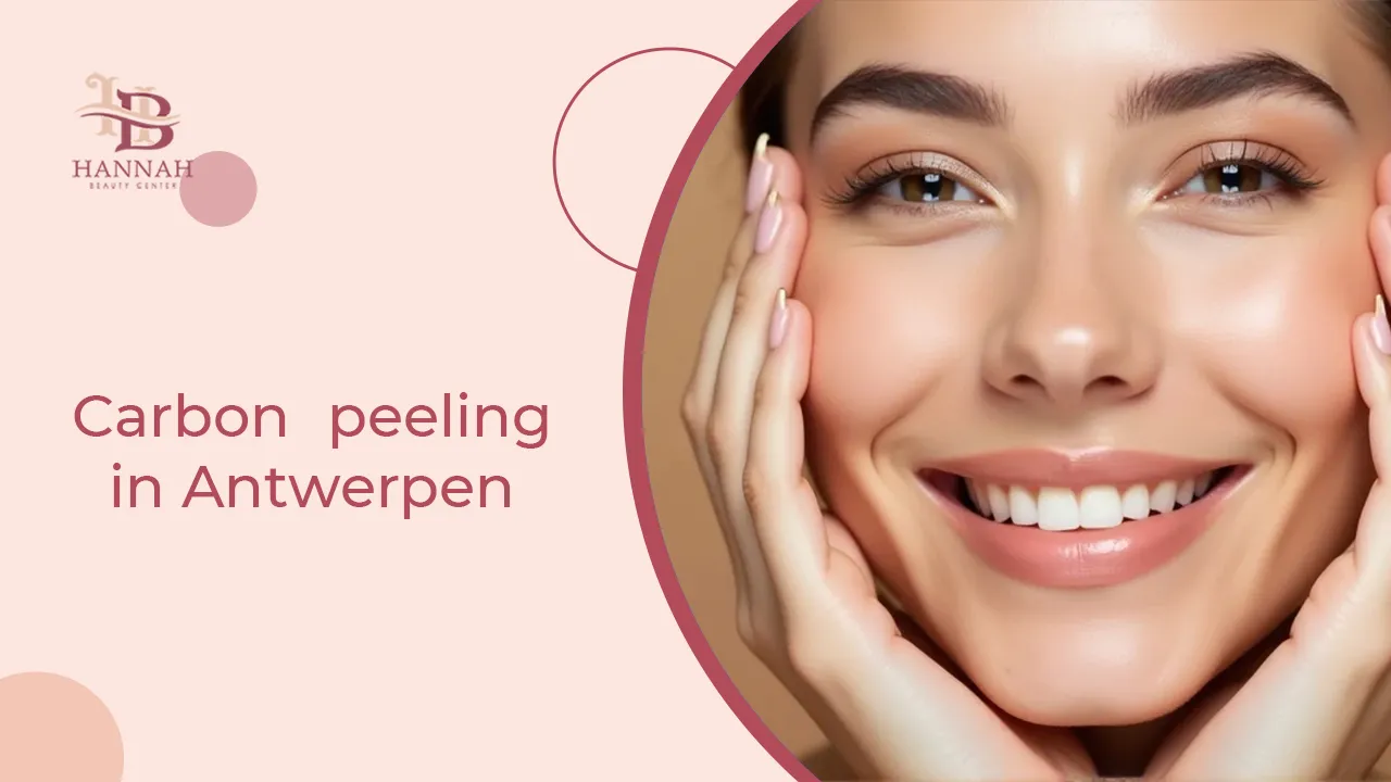 Carbon peeling in Antwerpen
