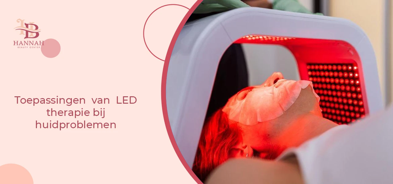 Toepassingen van LED therapie bij huidproblemen