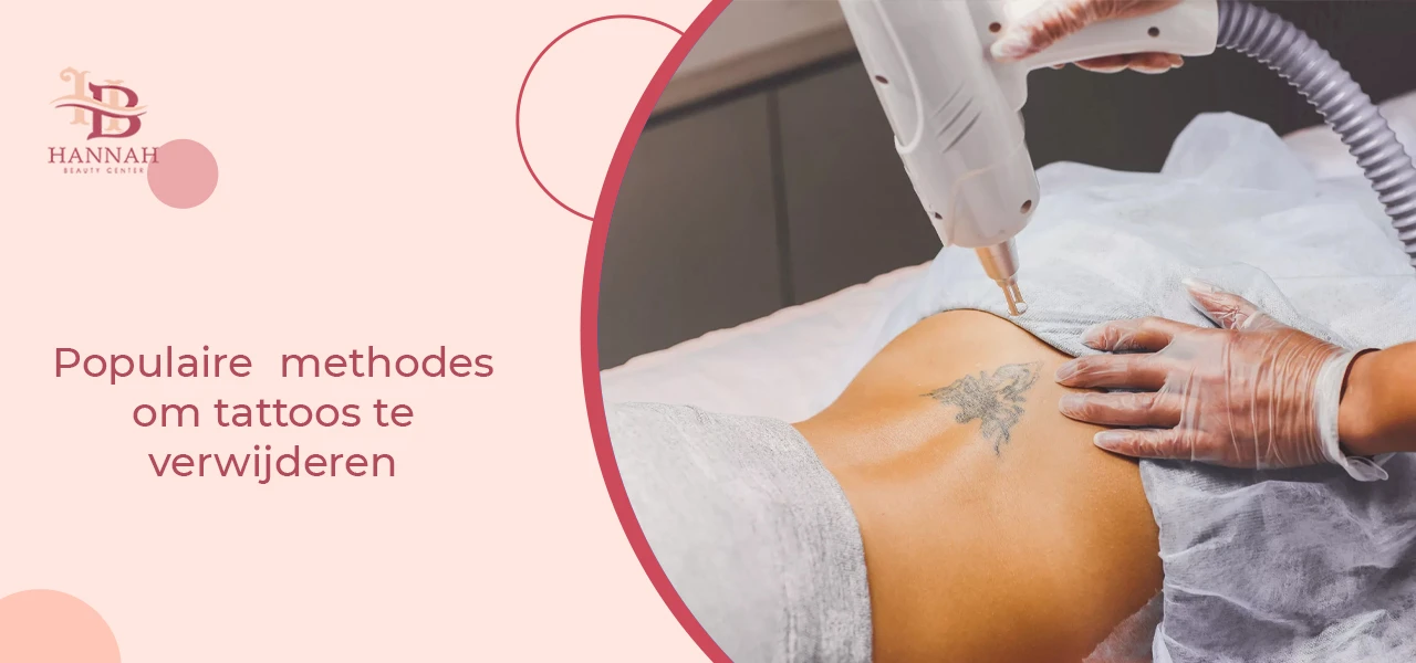 Populaire methodes om tattoos te verwijderen