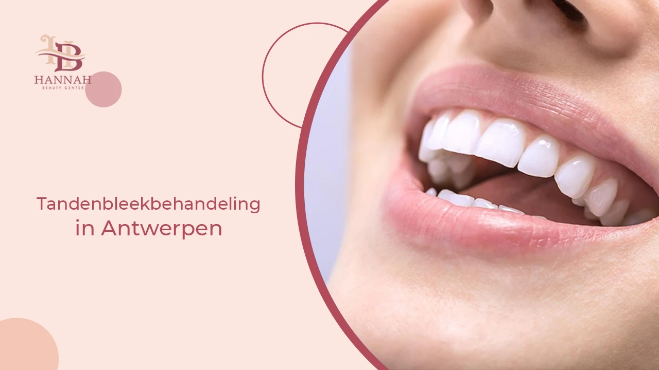Tandenbleekbehandeling in Antwerpen