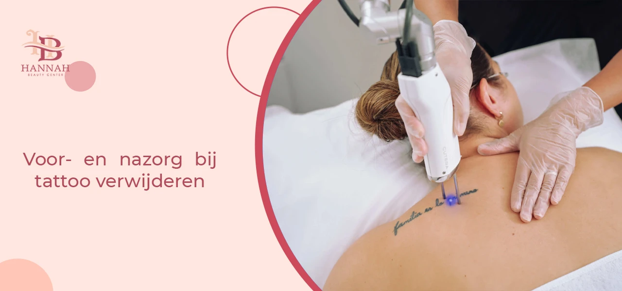 Voor- en nazorg bij tattoo verwijderen
