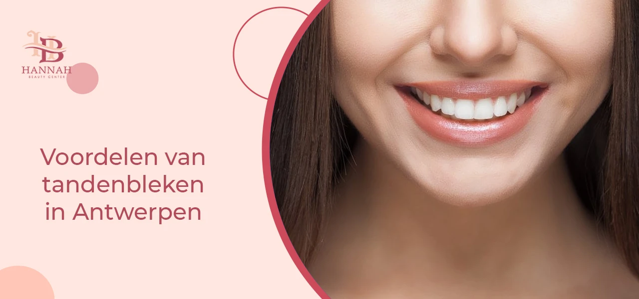 Voordelen van tandenbleken in Antwerpen