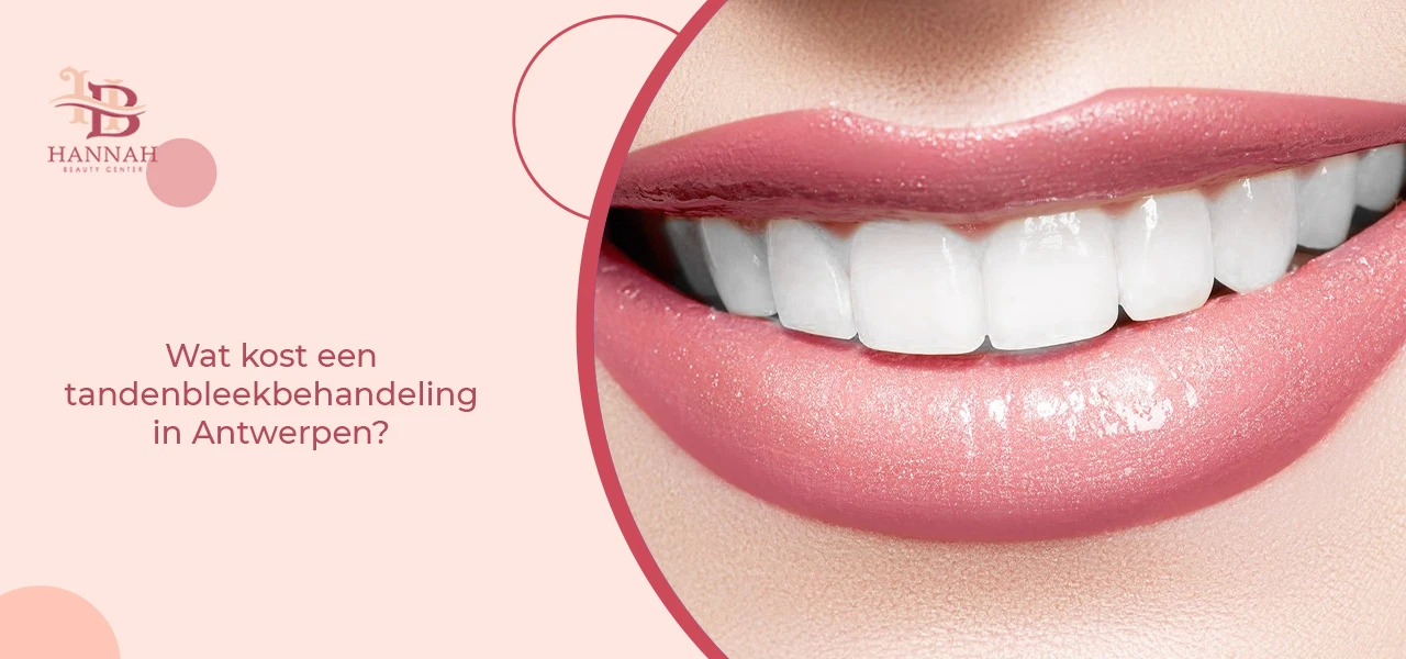 Wat kost een tandenbleekbehandeling in Antwerpen?