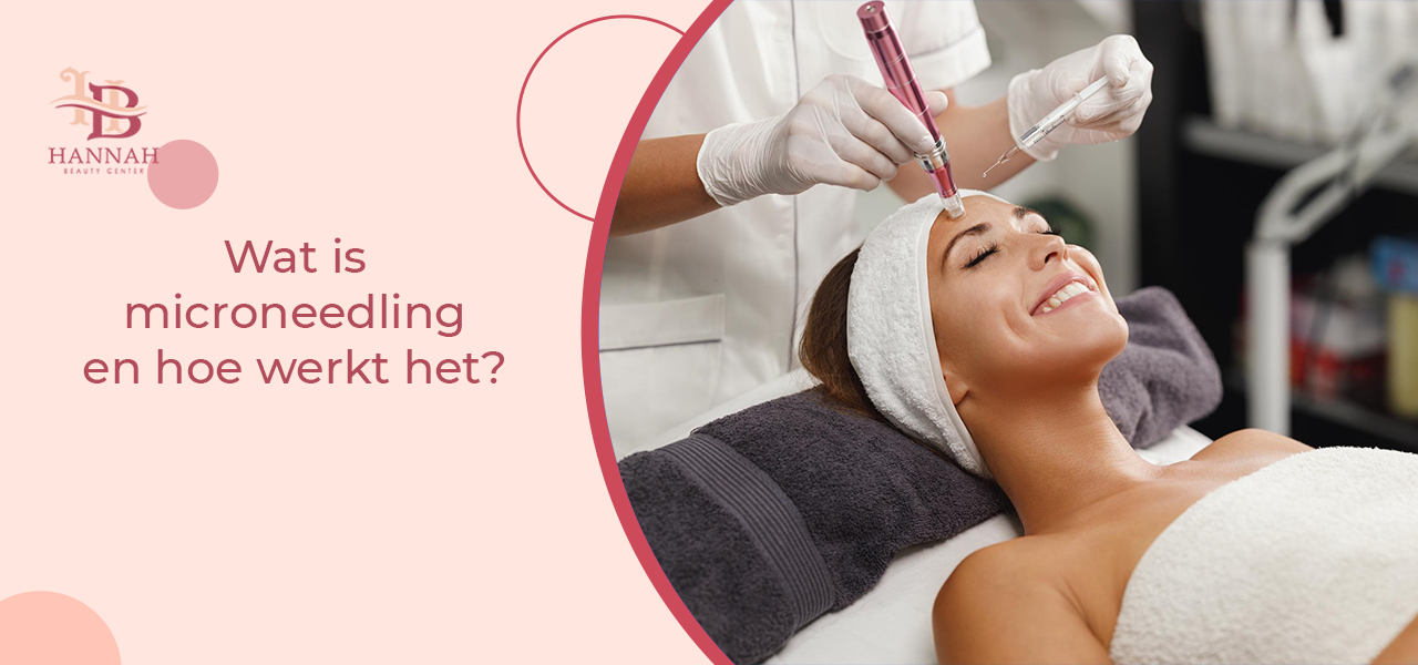 Wat is microneedling en hoe werkt het