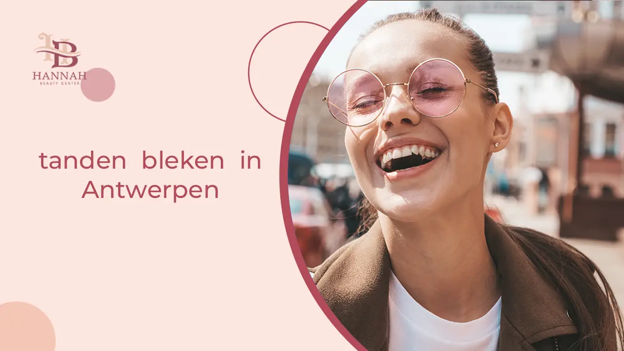 tandbleekbehandeling in Antwerpen