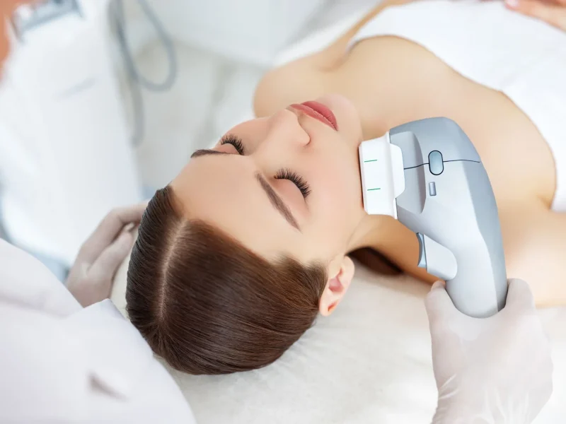 HIFU-Facelift HIFU Facelift